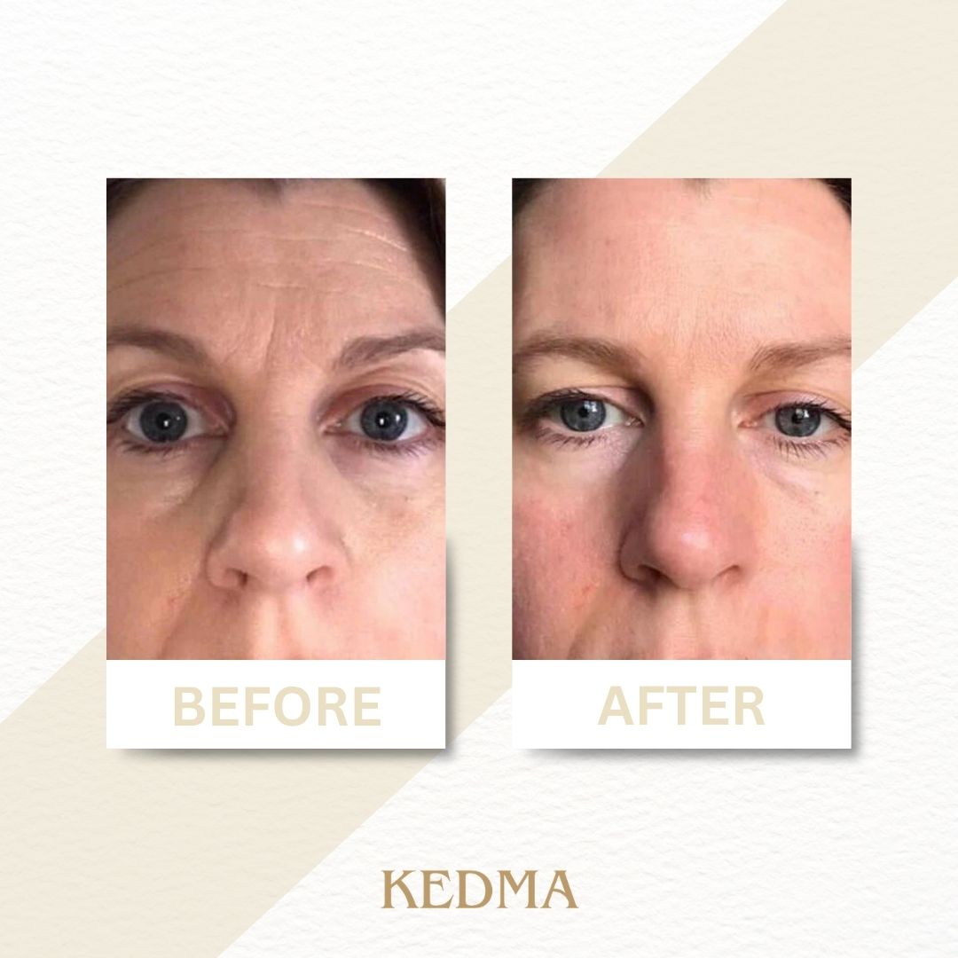 Kedma - Serum Booster met Marine Collageen en Mineralen uit de Dode Zee
