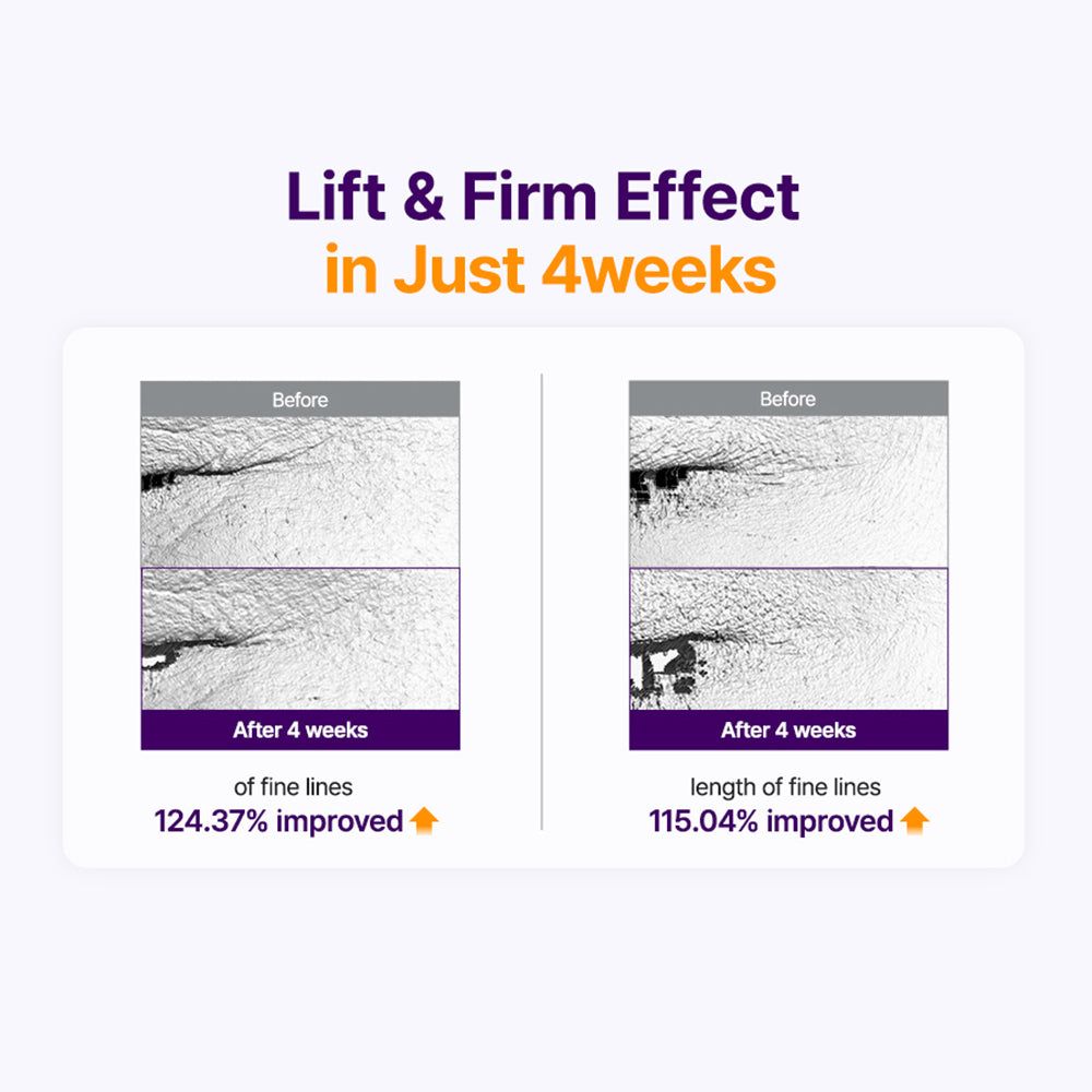 Comparaison avant/après de l'amélioration de la peau par le sérum Purito Retinol Retinal 2000 NAD+.