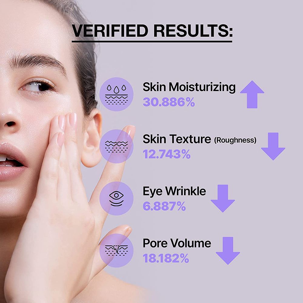 Gezicht van een vrouw die haar wang aanraakt. Grafiek met percentages huidverbetering.