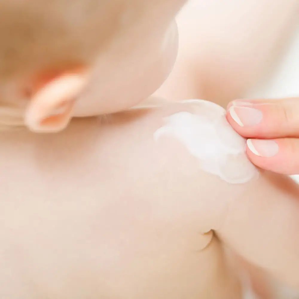 Close-up van een baby wiens huid wordt ingesmeerd met crème. Alleen arm en schouder zichtbaar. Witte crème.