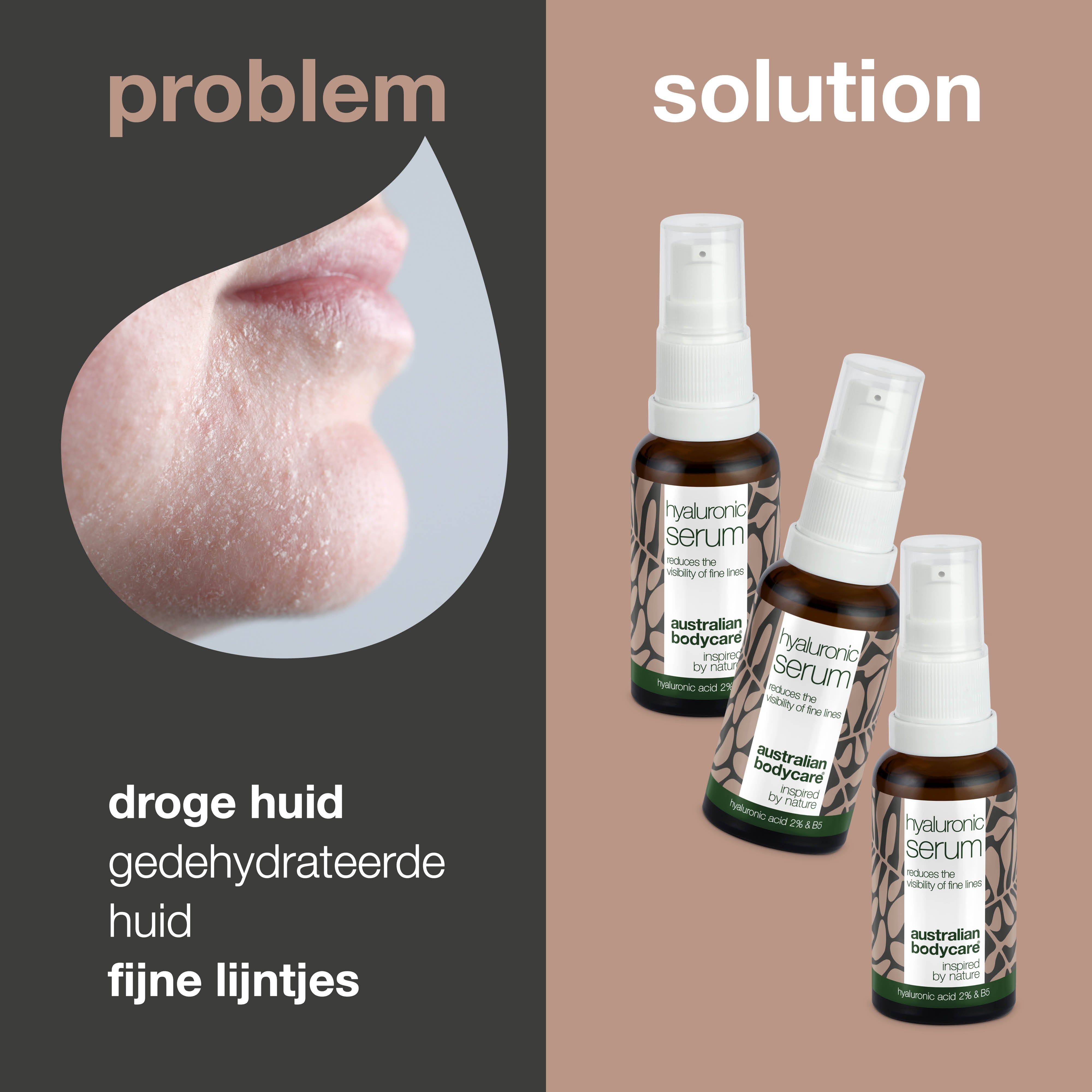 Vergelijking van huidcondities. Opschrift: Hyaluronic Serum, Australian Bodycare.