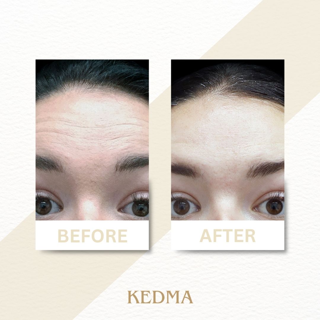 Kedma - Crème Visage au Collagène et Minéraux de la Mer Morte
