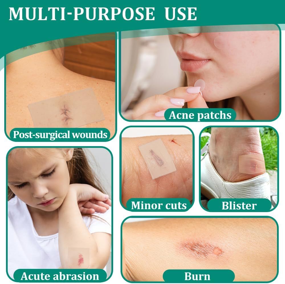 Exemples d'utilisation de pansements : post-opératoire, petites coupures, ampoules, abrasion aiguë, brûlure. Différentes zones de la peau.