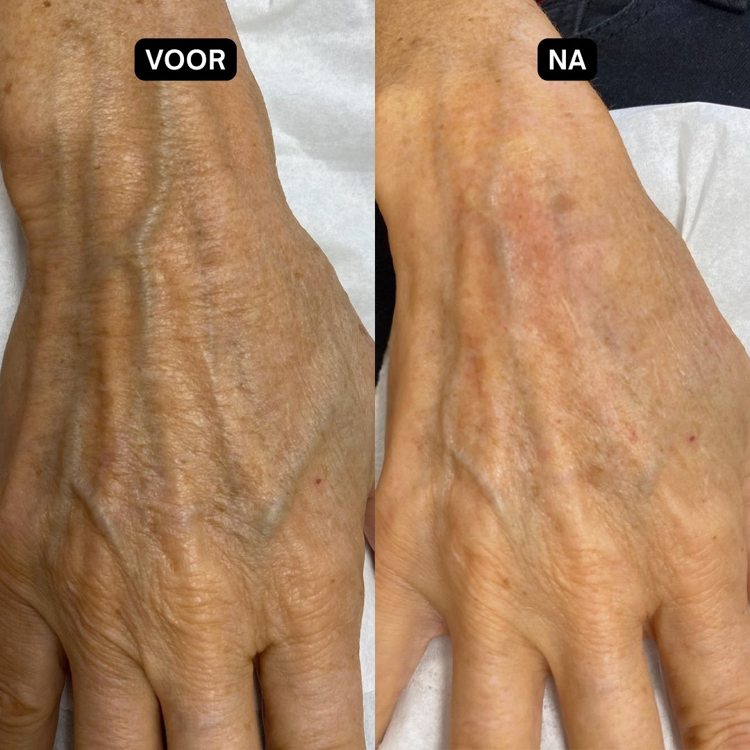 Crèmetube. Opschrift: Dr. SEA, Nourishing Hand Cream. Voor normale en droge huid. Witte dop.