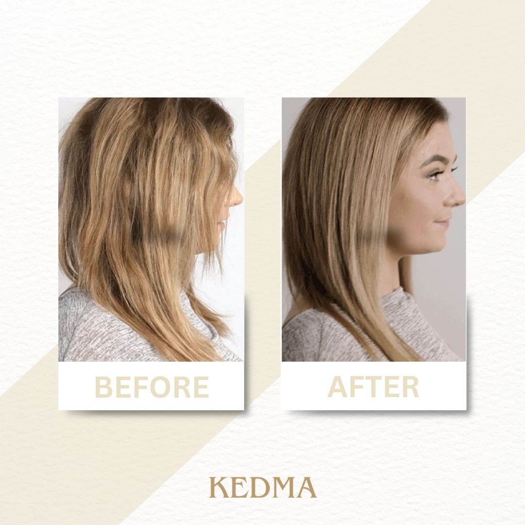 Kedma - Herstellend Haarserum met Keratine
