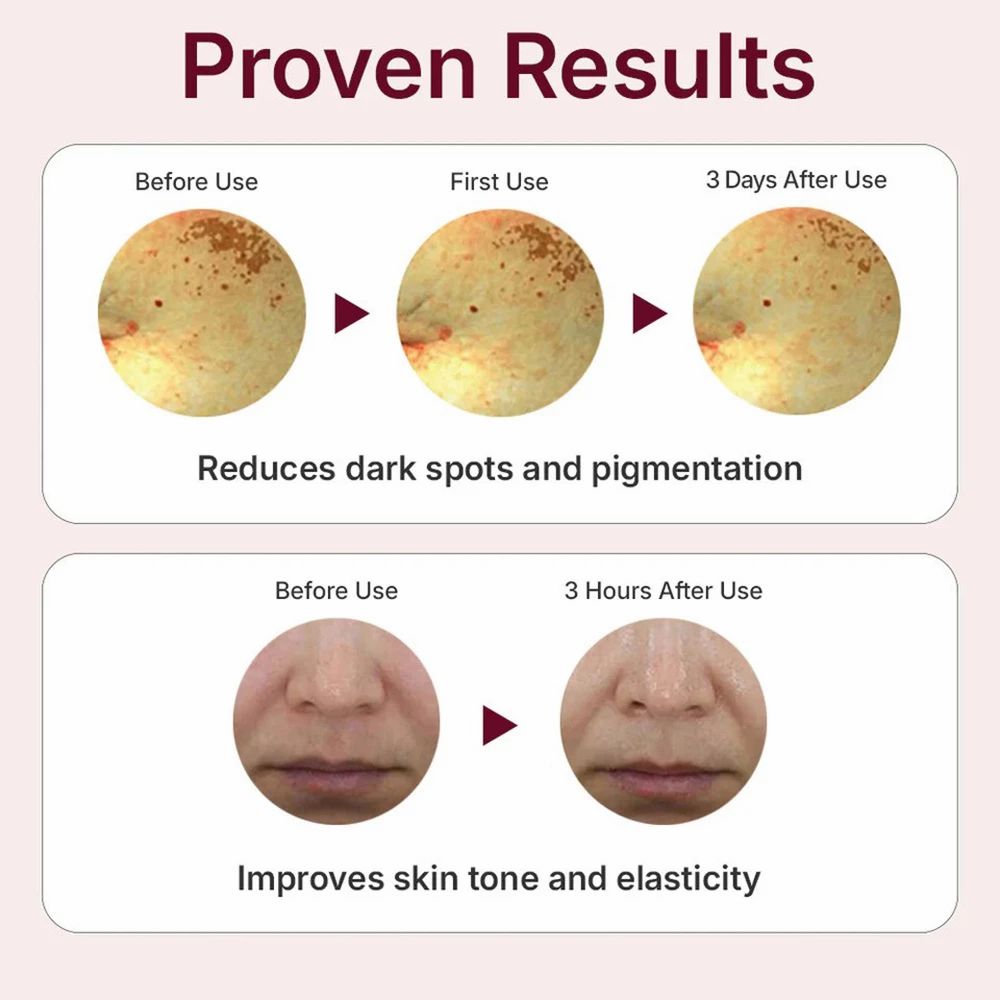 CENTELLIAN24 Expert Madeca Mela Capture Ampoule Max – sérum anti-taches éclaircissant