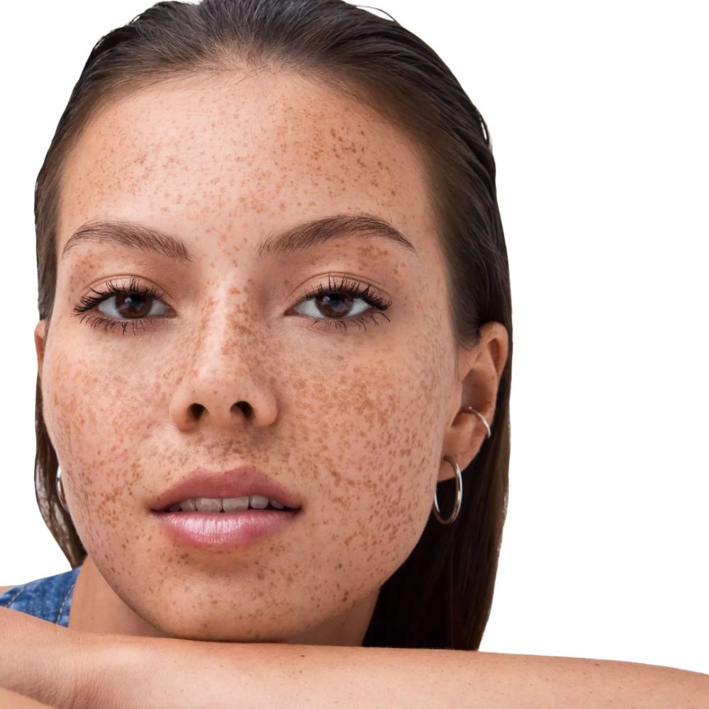 Close-up van een gezicht. Jonge vrouw met sproeten. Ze kijkt de camera in.