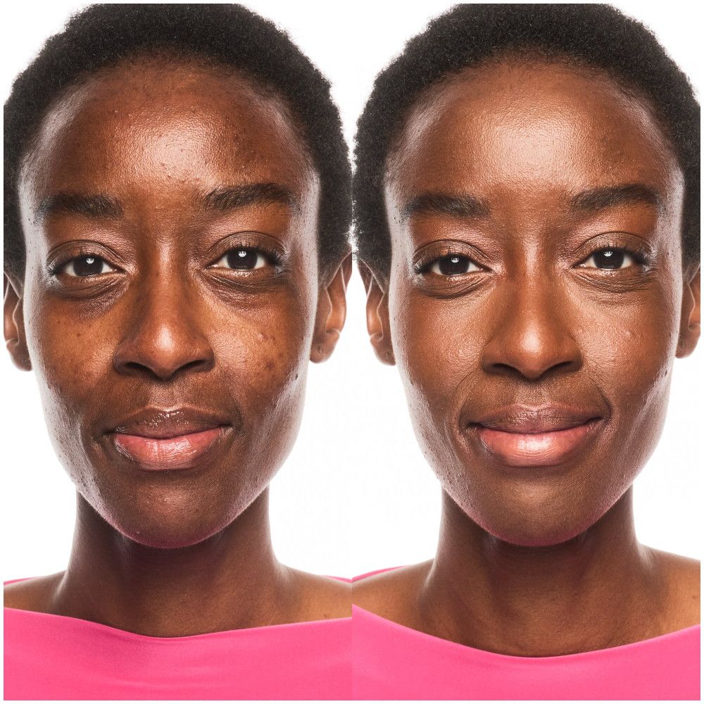 Gezicht voor en na het aanbrengen van foundation. Huidtint verbeterd. Links: voor, rechts: na.