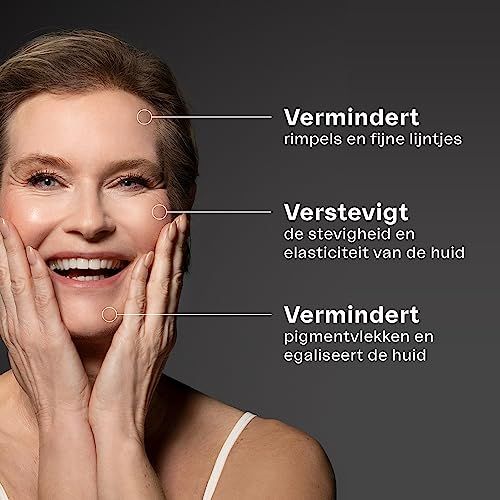 Close-up van een microneedling-apparaat. Tekst: Hoogwaardig staal, verwisselbare roller, ergonomische grip, professioneel.