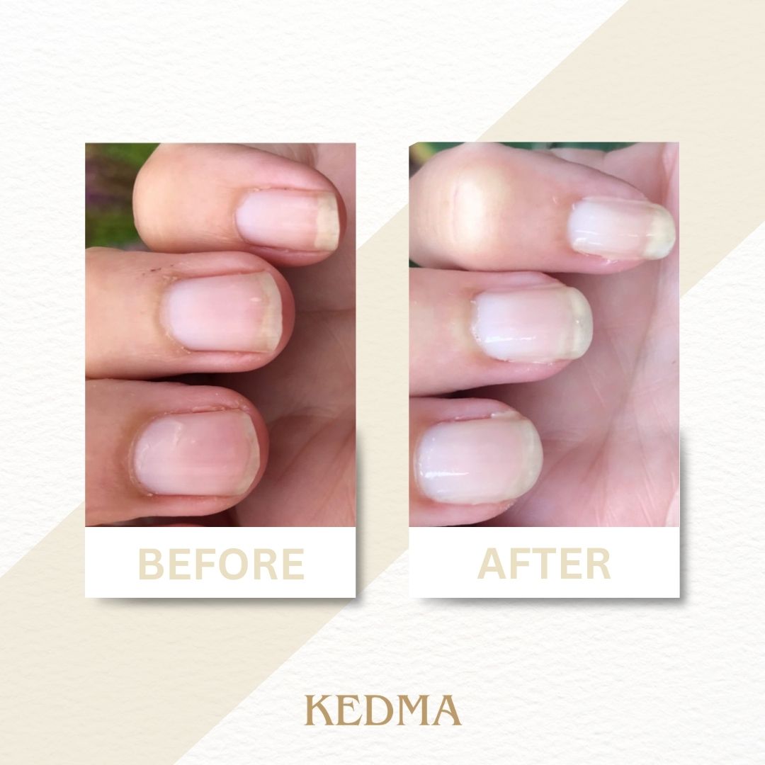 Kedma - Coffret Soin des Ongles Golden Touch aux Minéraux de la Mer Morte