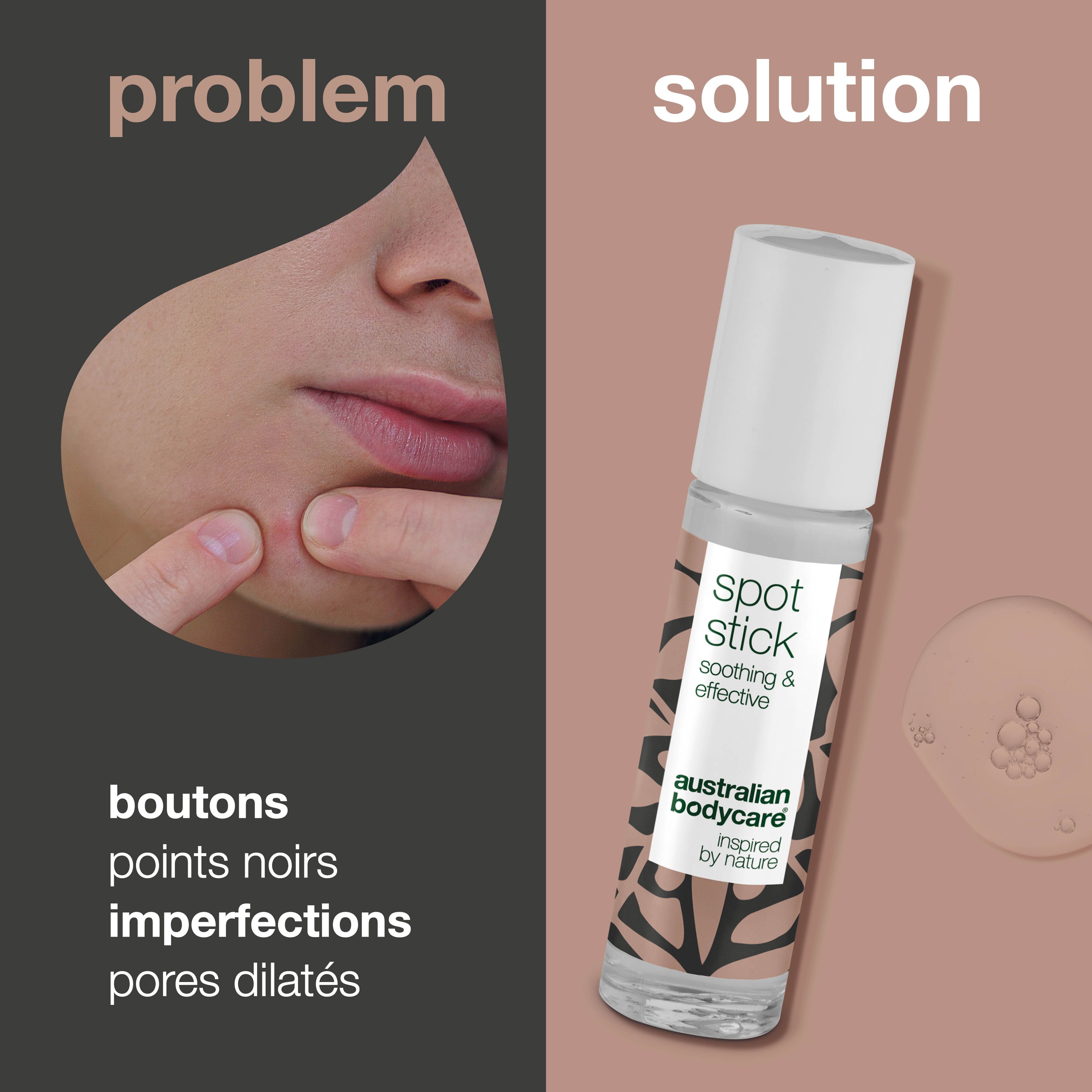 Visage avec boutons et stick roll-on. Inscription : Spot Stick, soothing & effective, Australian Bodycare.