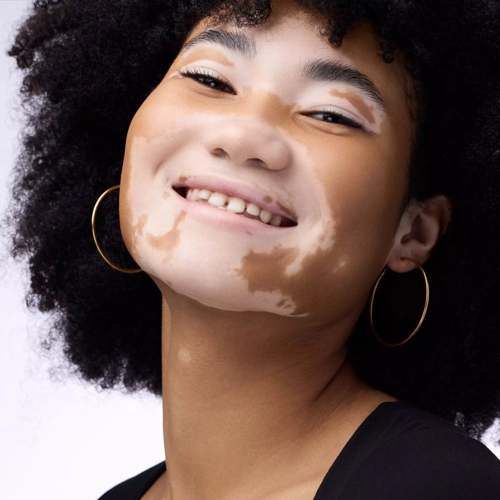 Portret van een vrouw met huidonvolkomenheden. Ze glimlacht. Gouden oorbellen.