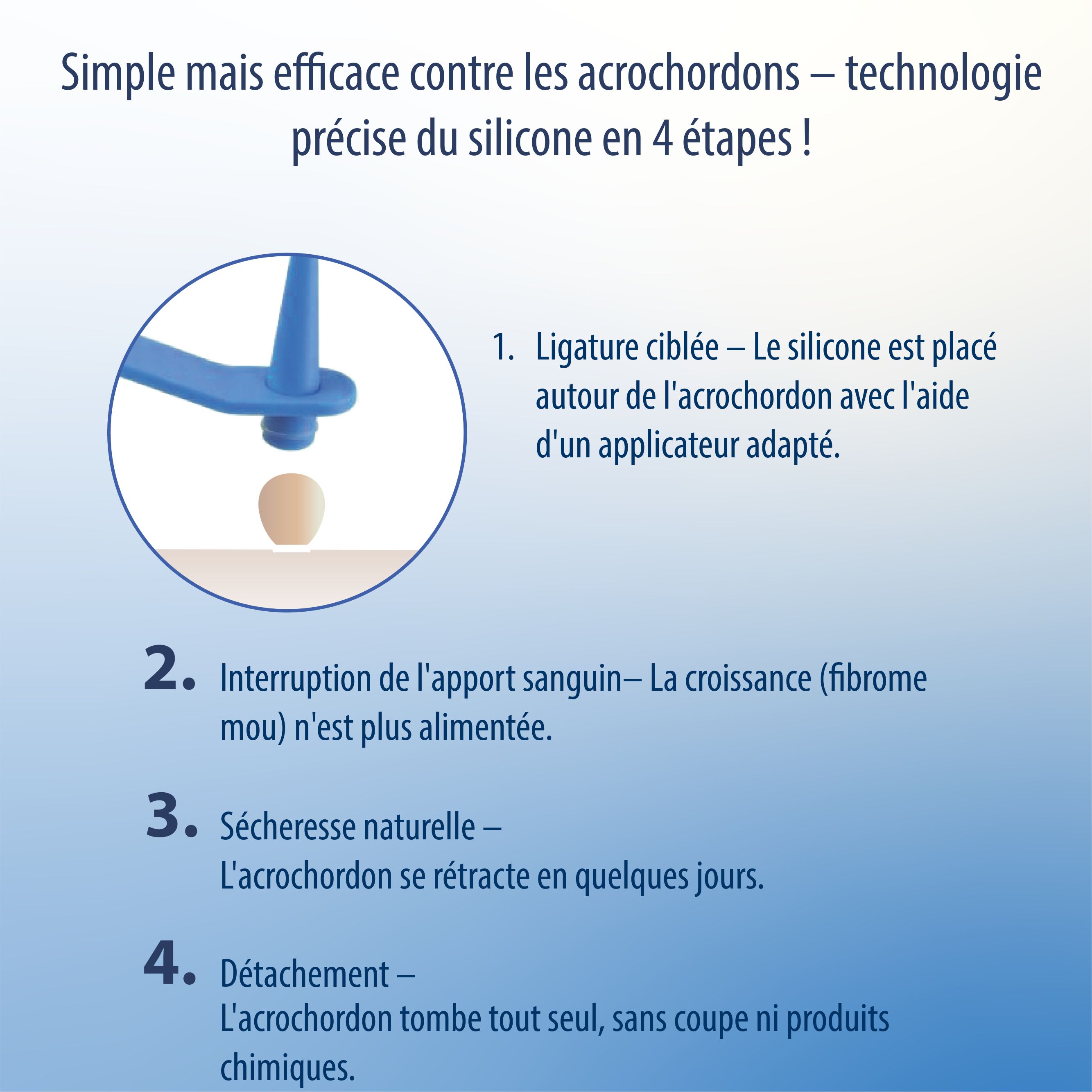 Evolsin Anti Stielwarze : Comparaison avec d'autres méthodes comme cryothérapie ou élimination chimique.