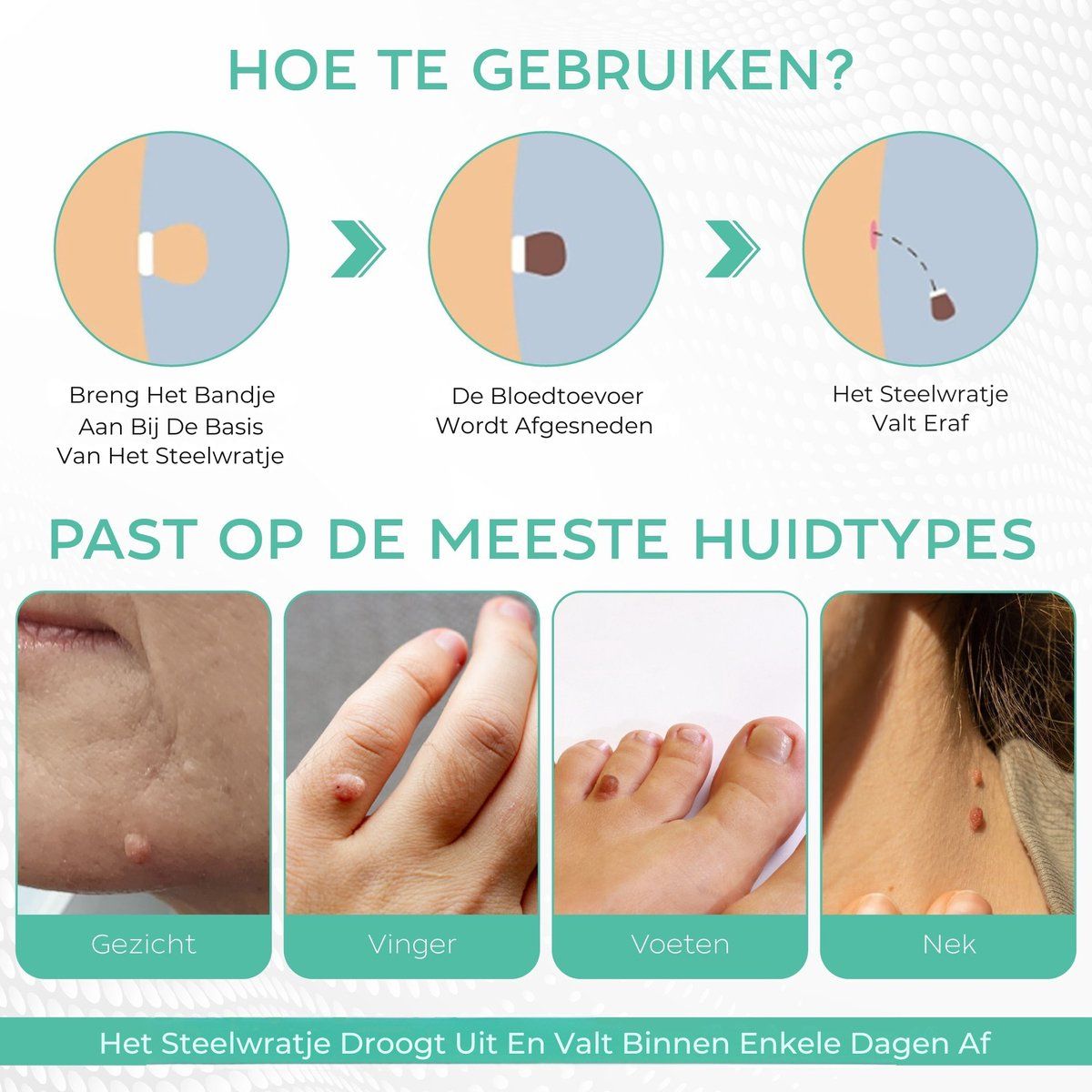 Illustratie van gebruik. Huidlabels op gezicht, vingers, voeten en nek. Drogen en vallen af.