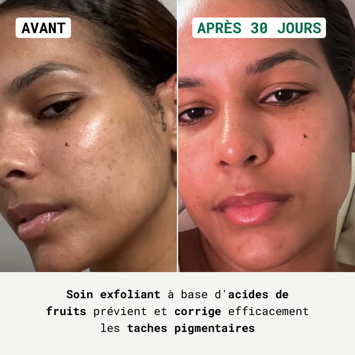 Voor-na vergelijking. Gezicht met pigmentvlekken, dan egalere teint. Tekst: Exfoliërende verzorging voorkomt pigmentvlekken.