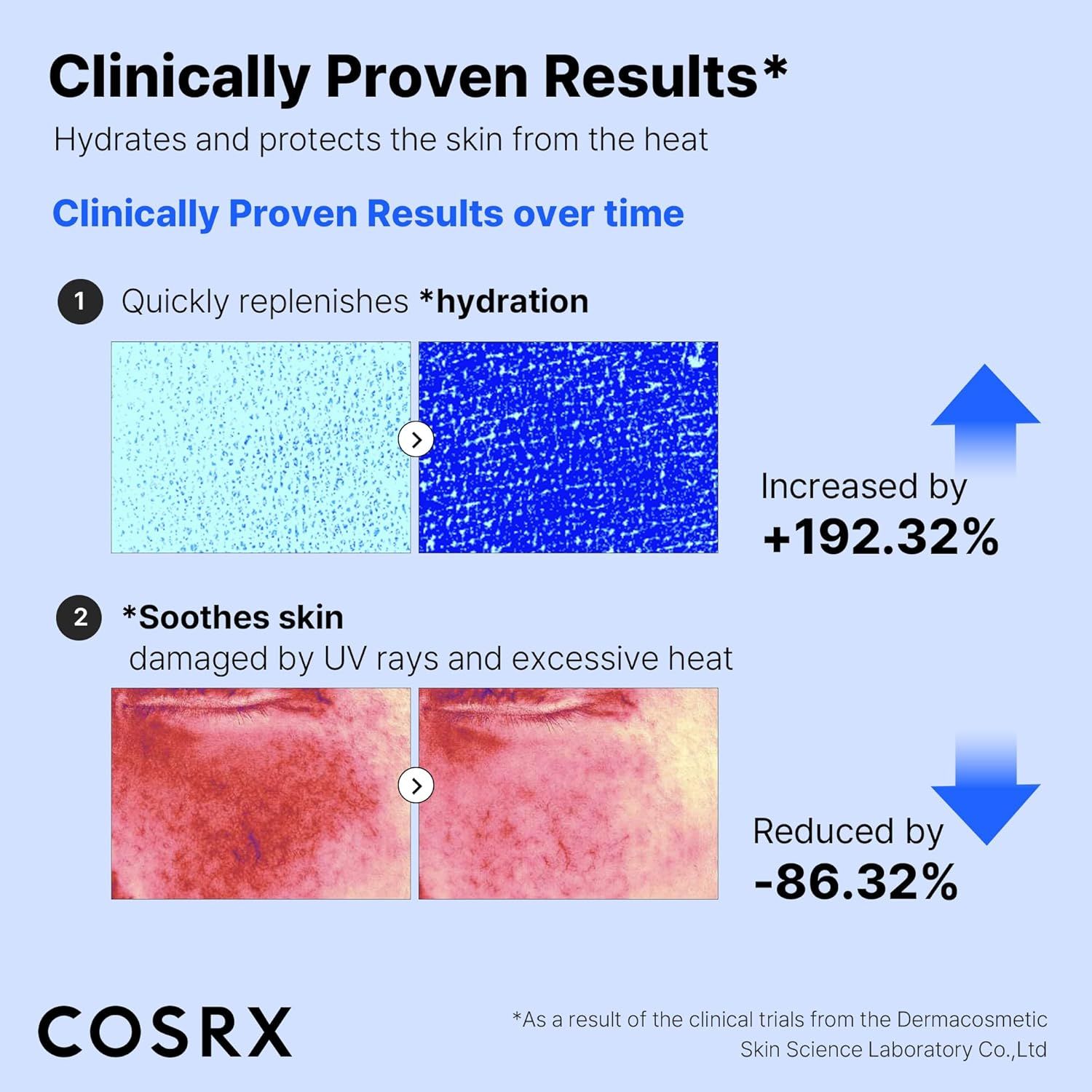 Graphique: Résultats cliniquement prouvés. Hydratation augmentée de +192,32%. Apaisement cutané réduit de -86,32%. Marque: COSRX.