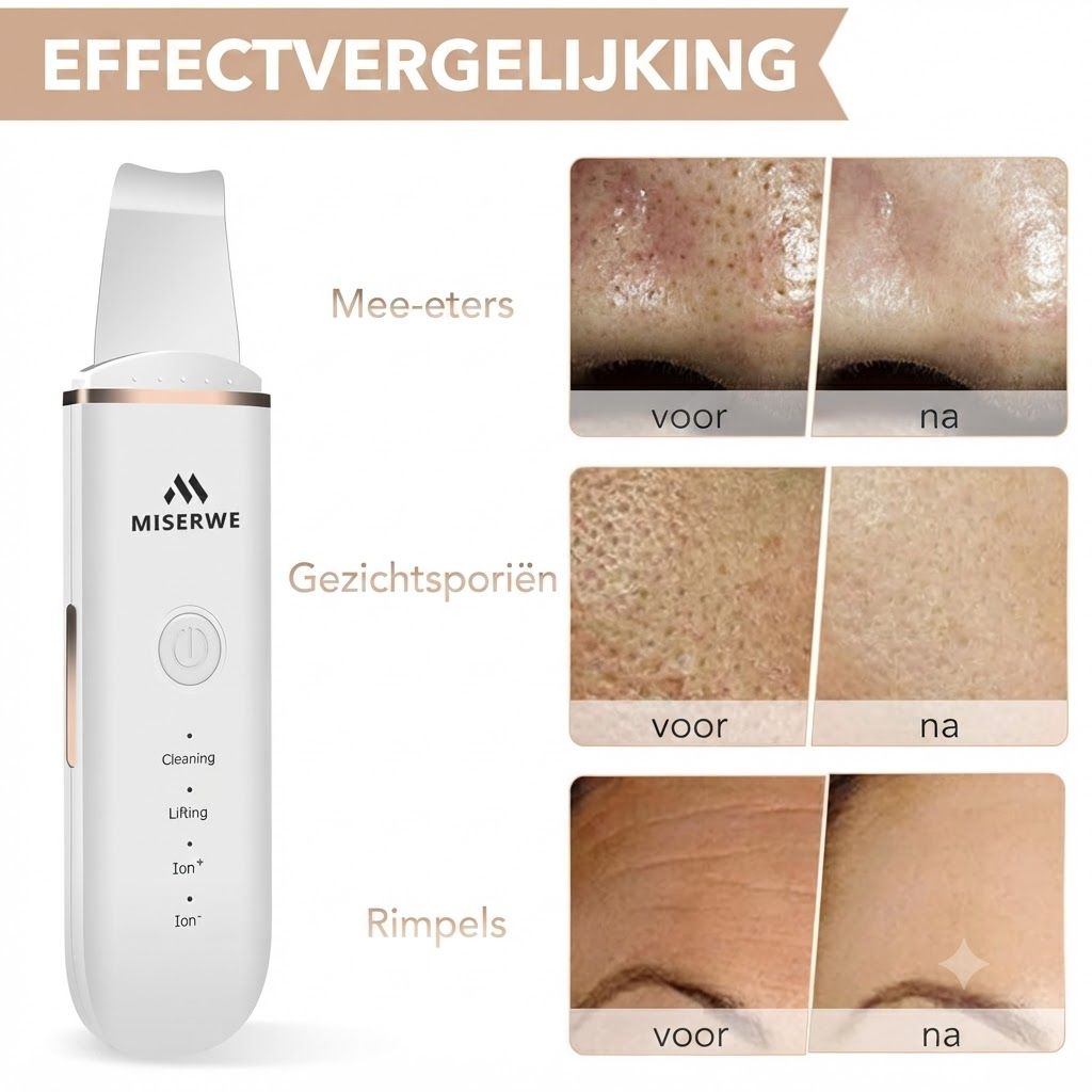Een wit huidverzorgingsapparaat van het merk MISERWE voor diepe reiniging en versteviging. Toont voor-en-na resultaten voor mee-eters, poriën en rimpels.