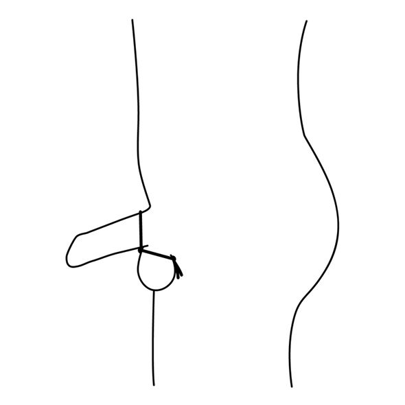 Schematische weergave van een penis met een cockring. De ring is om de penis geplaatst.
