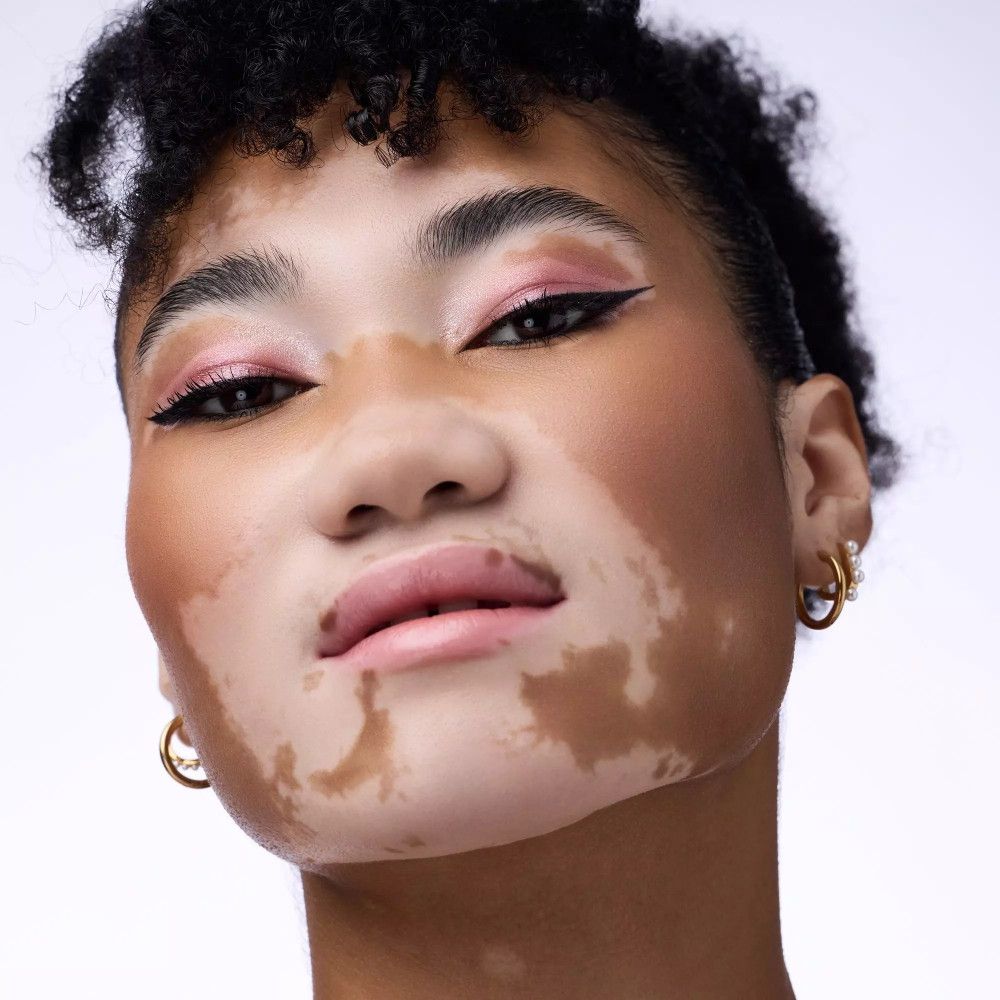 Portrait d'une personne atteinte de vitiligo. Fard à paupières rose et eye-liner noir. Boucles d'oreilles dorées.
