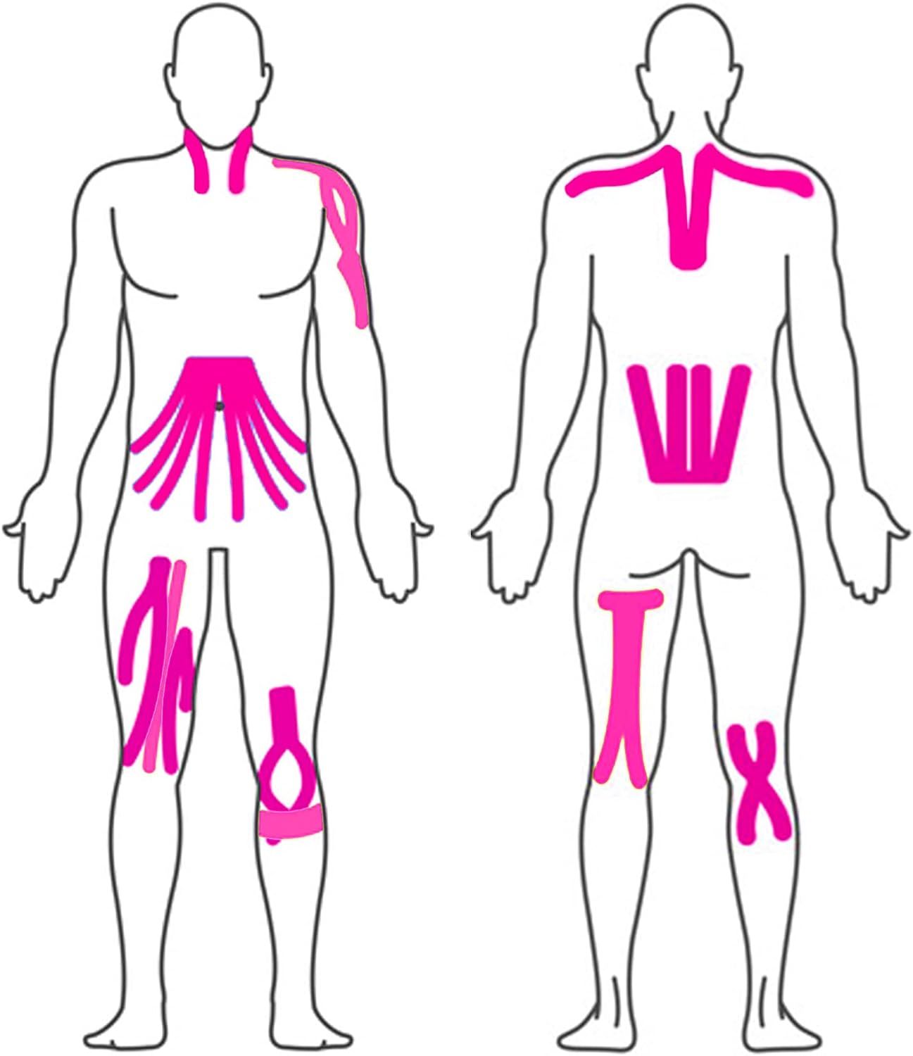 Schema voor de toepassing van kinesiologie tape op het menselijk lichaam.