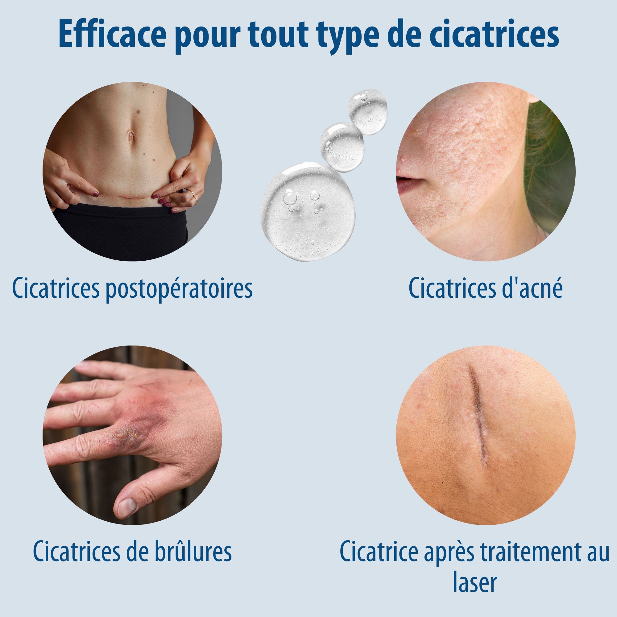 Tube Evolsin Gel pour cicatrices, 20 g. Gel pour cicatrices de tous types. CE.