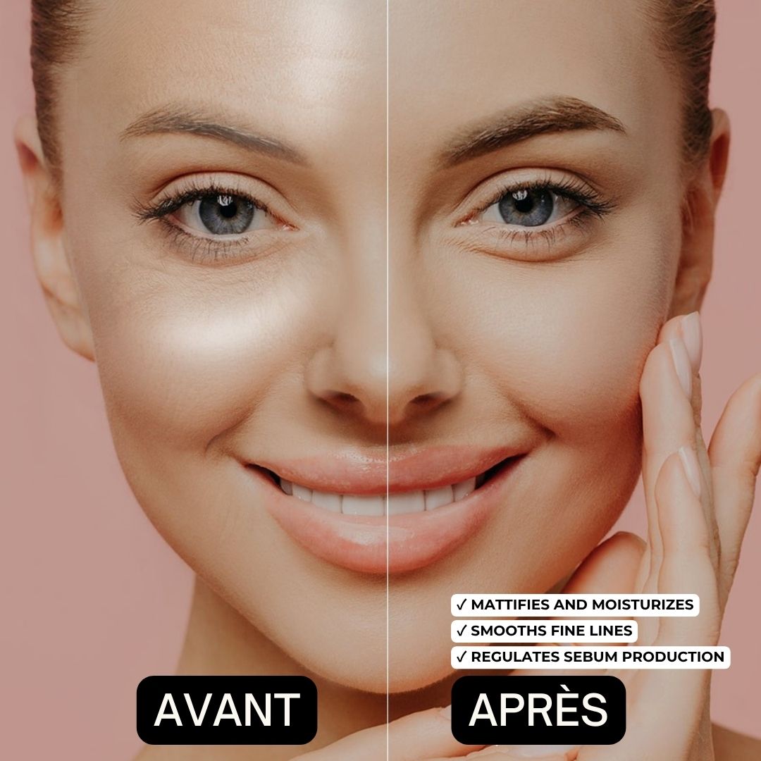 Comparaison avant-après. Visage d'une femme. Texte : Avant, Après, Mattifie et hydrate, Adoucit les ridules, Régule la production de sébum.