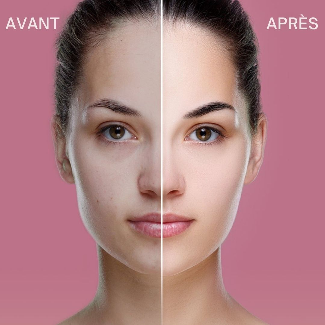 Image avant-après d'une femme. La moitié gauche du visage montre des imperfections, la droite une peau lisse.