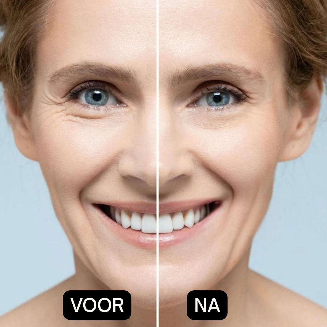 Voor- en na-afbeelding van een vrouw. De linkerhelft van het gezicht toont rimpels, de rechter een gladde huid.