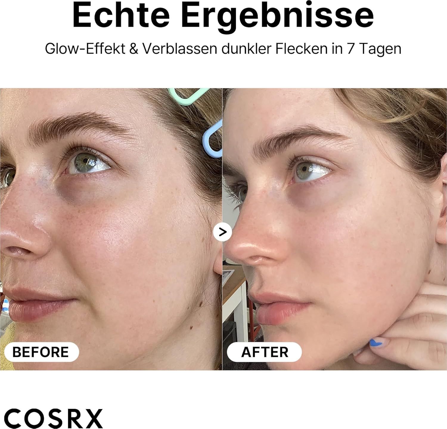 Comparaison avant-après de visages. Gauche : peau avec imperfections. Droite : peau avec teint amélioré. Logo COSRX en bas.