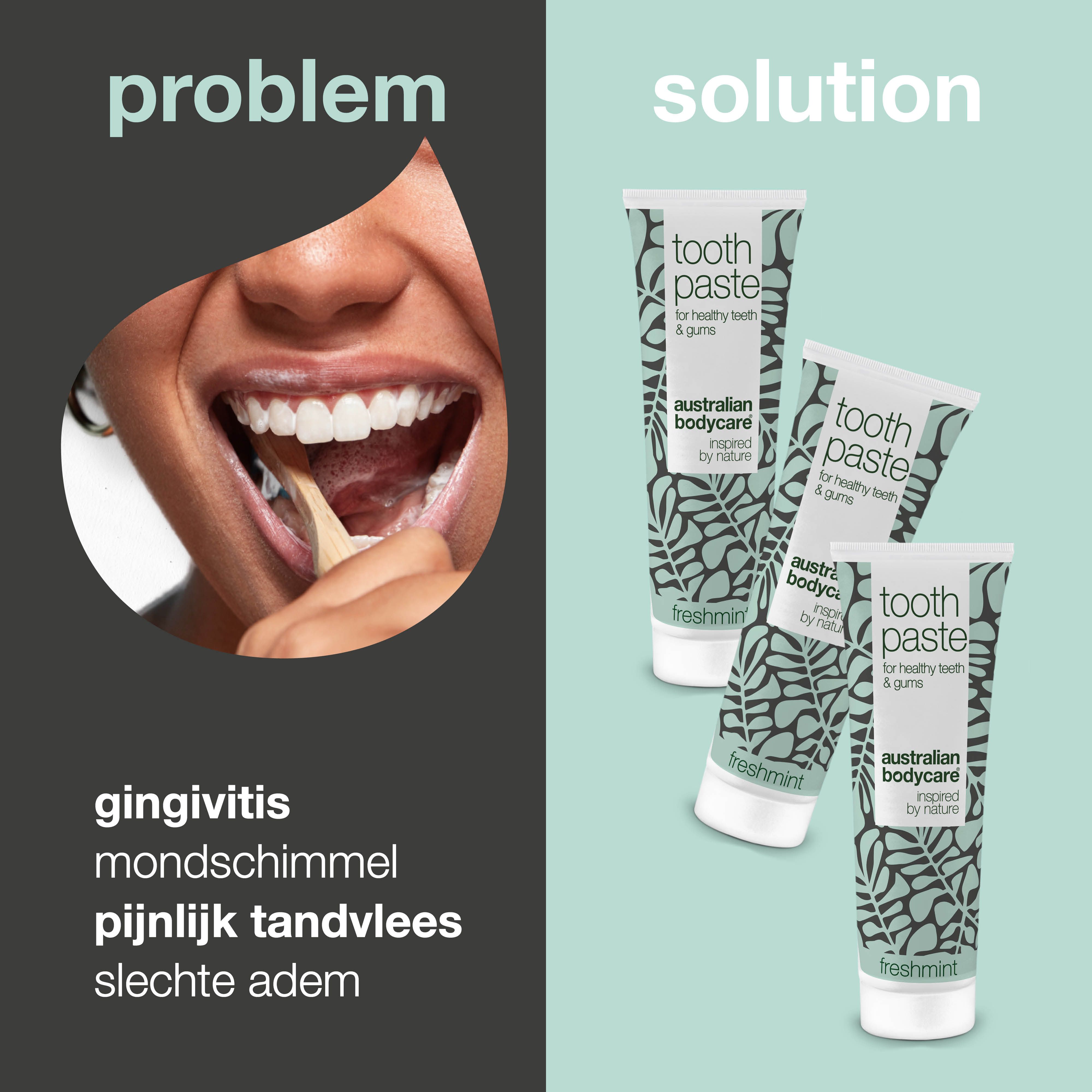 Tandpasta tubes en persoon die tanden poetst. Tekst: Gingivitis, slechte adem, gezwollen tandvlees.
