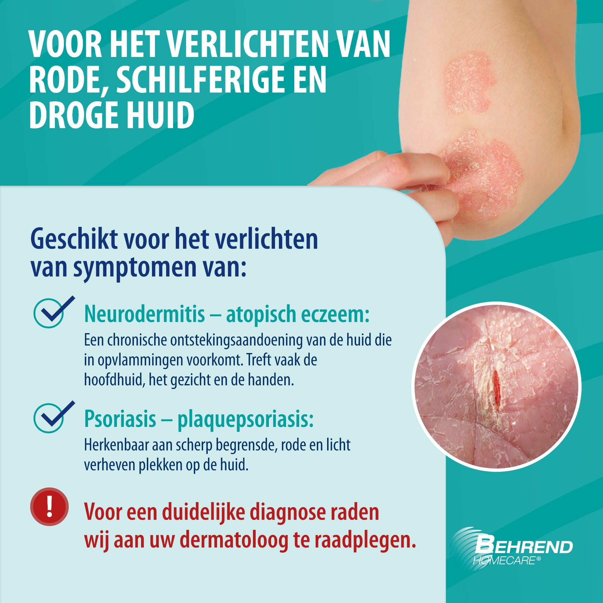 Crèmetube en doos Behrend Homecare. Medisch product. Voor rode, droge huid.