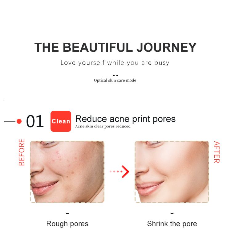 Voor-en-na vergelijking. Grove poriën naar kleinere poriën. Tekst: Reduce acne print pores.