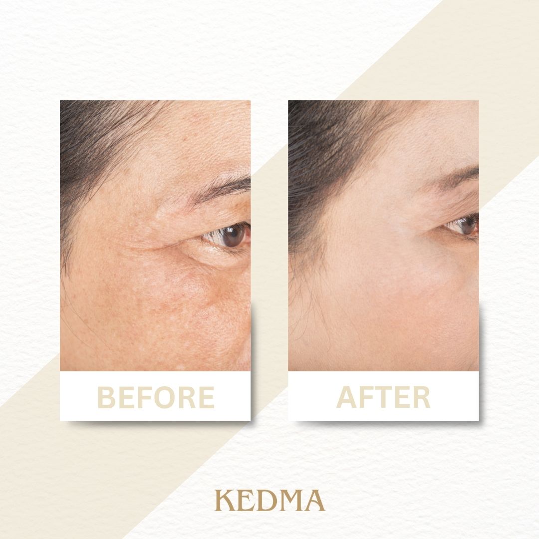 Kedma - Sérum Jour Élixir à l'Acide Hyaluronique et Vitamines