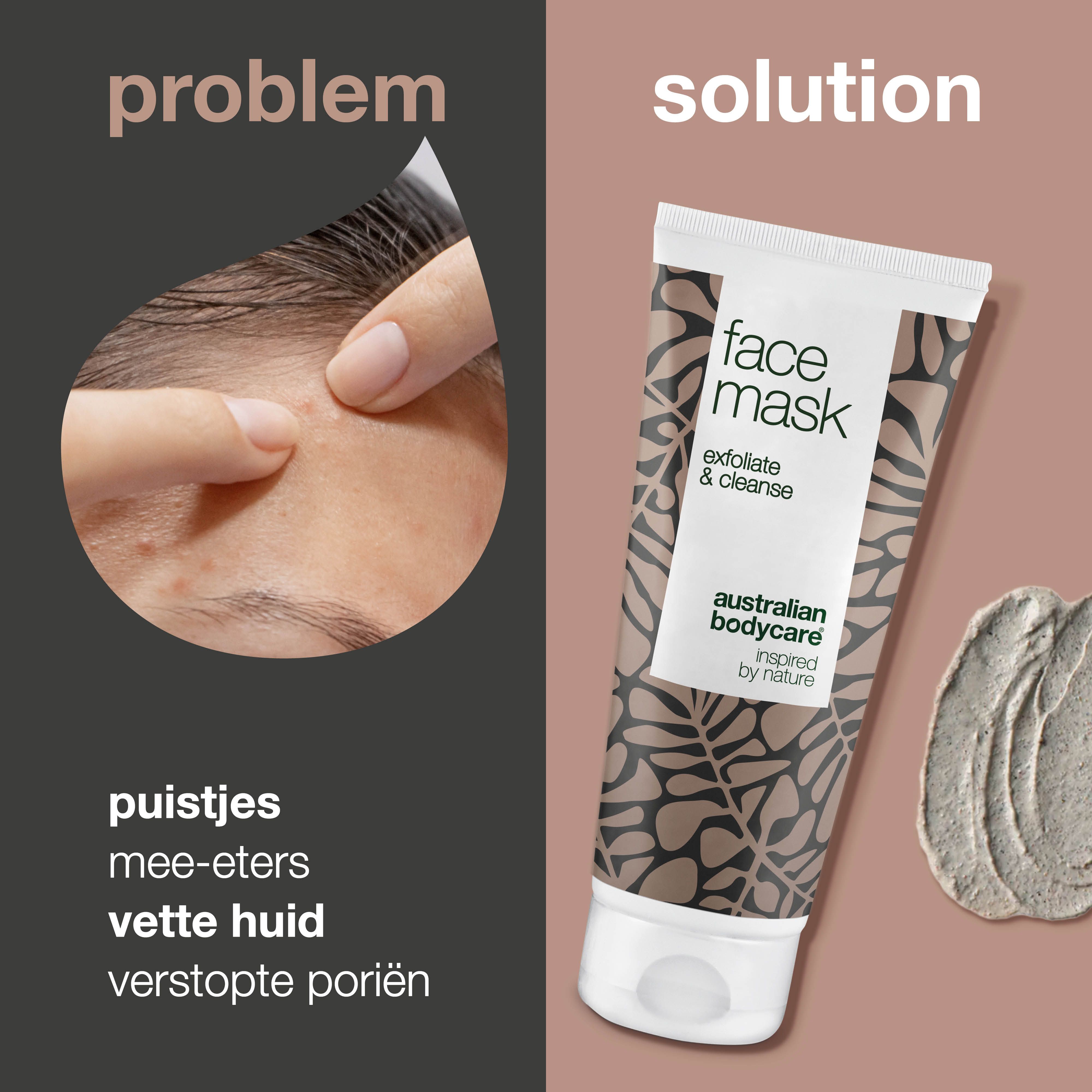 Probleem: puistjes, mee-eters, vette huid. Oplossing: gezichtsmasker tube, tekst: Face Mask, Australian Bodycare.