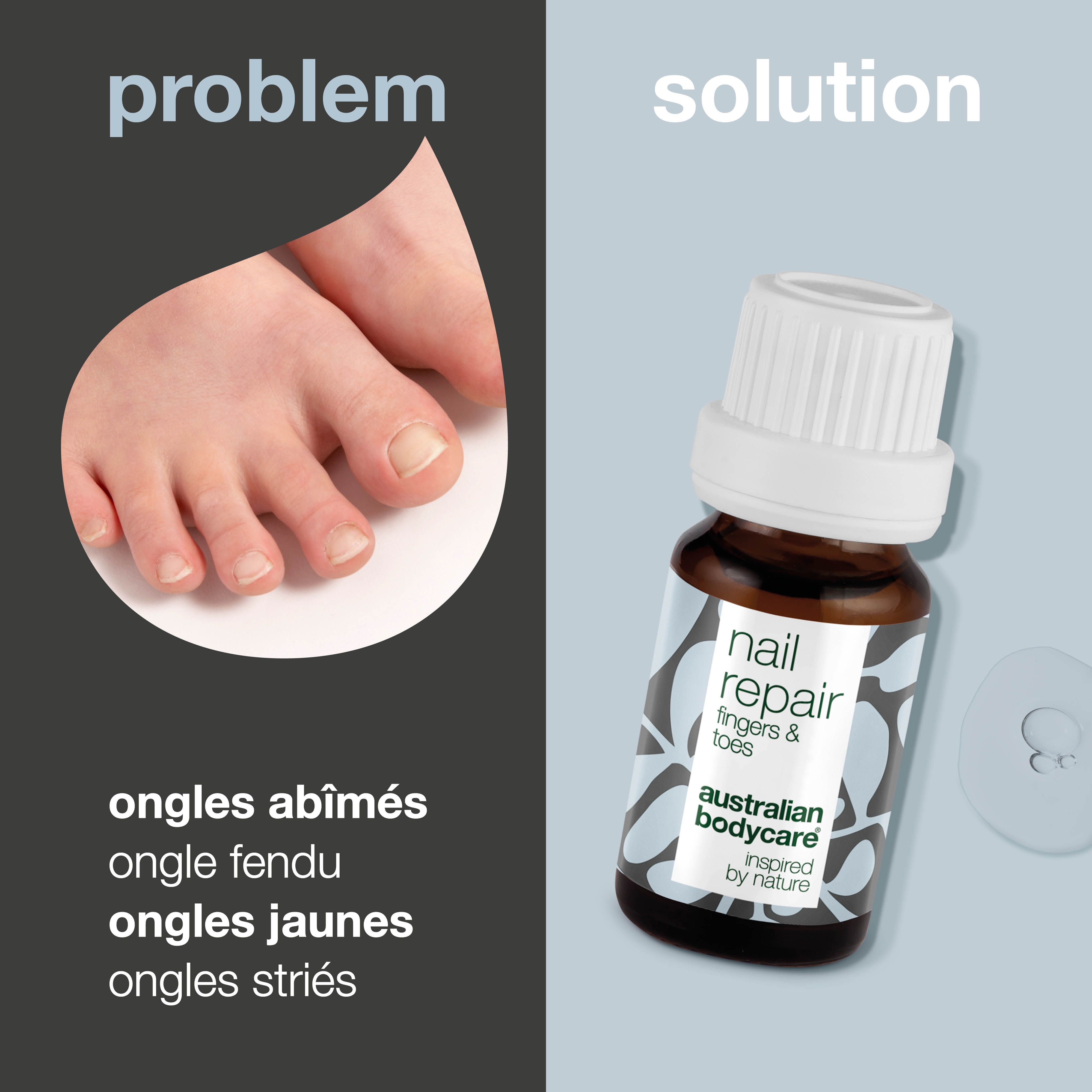 Problème : pied avec ongles abîmés, fendus, jaunes et striés. Solution : flacon « nail repair ».