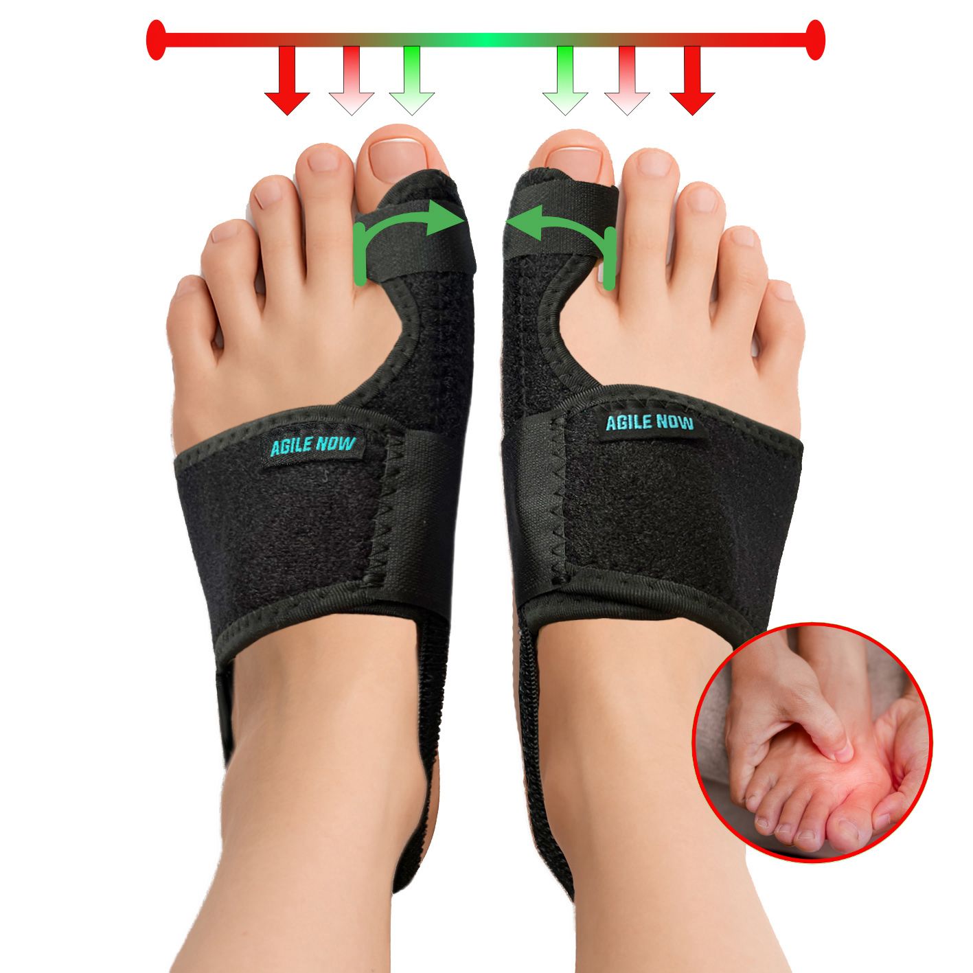 Twee voeten met Hallux Valgus bandages. Tekst: AGILE NOW. Pijlen tonen correctie. Rode en groene markeringen.
