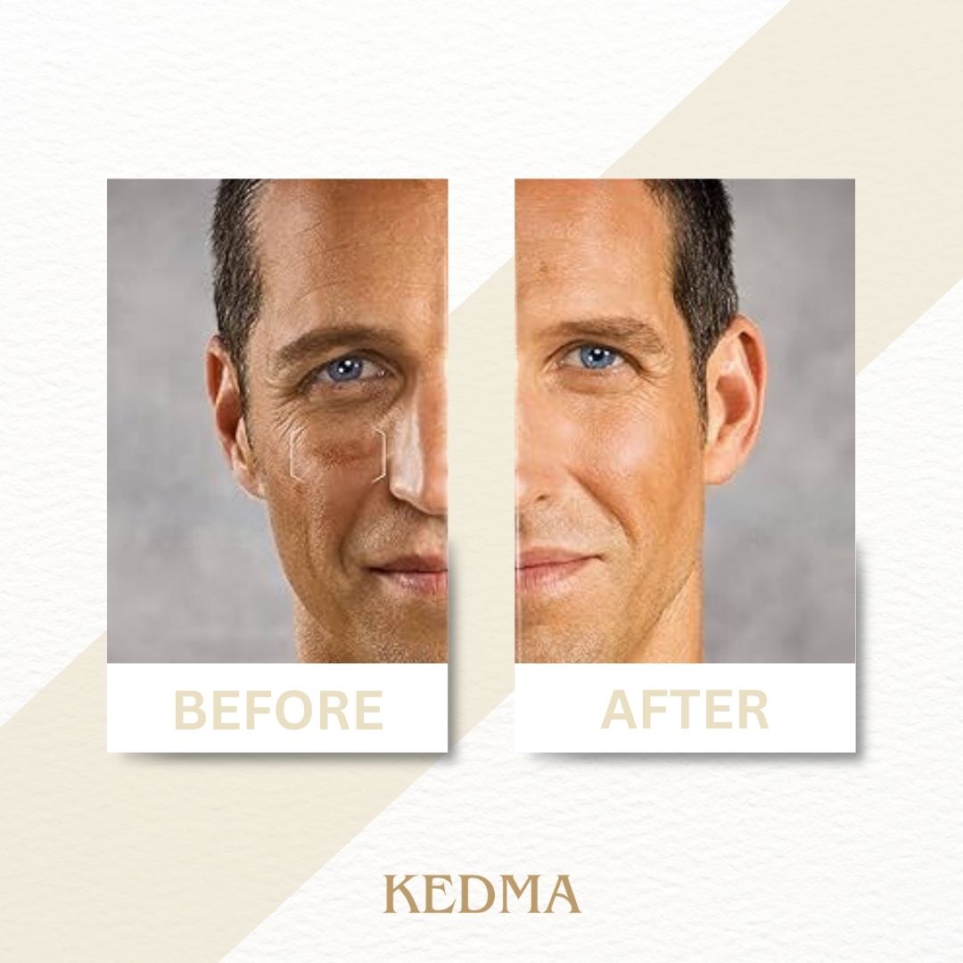Kedma - Sérum Visage Homme aux Minéraux de la Mer Morte