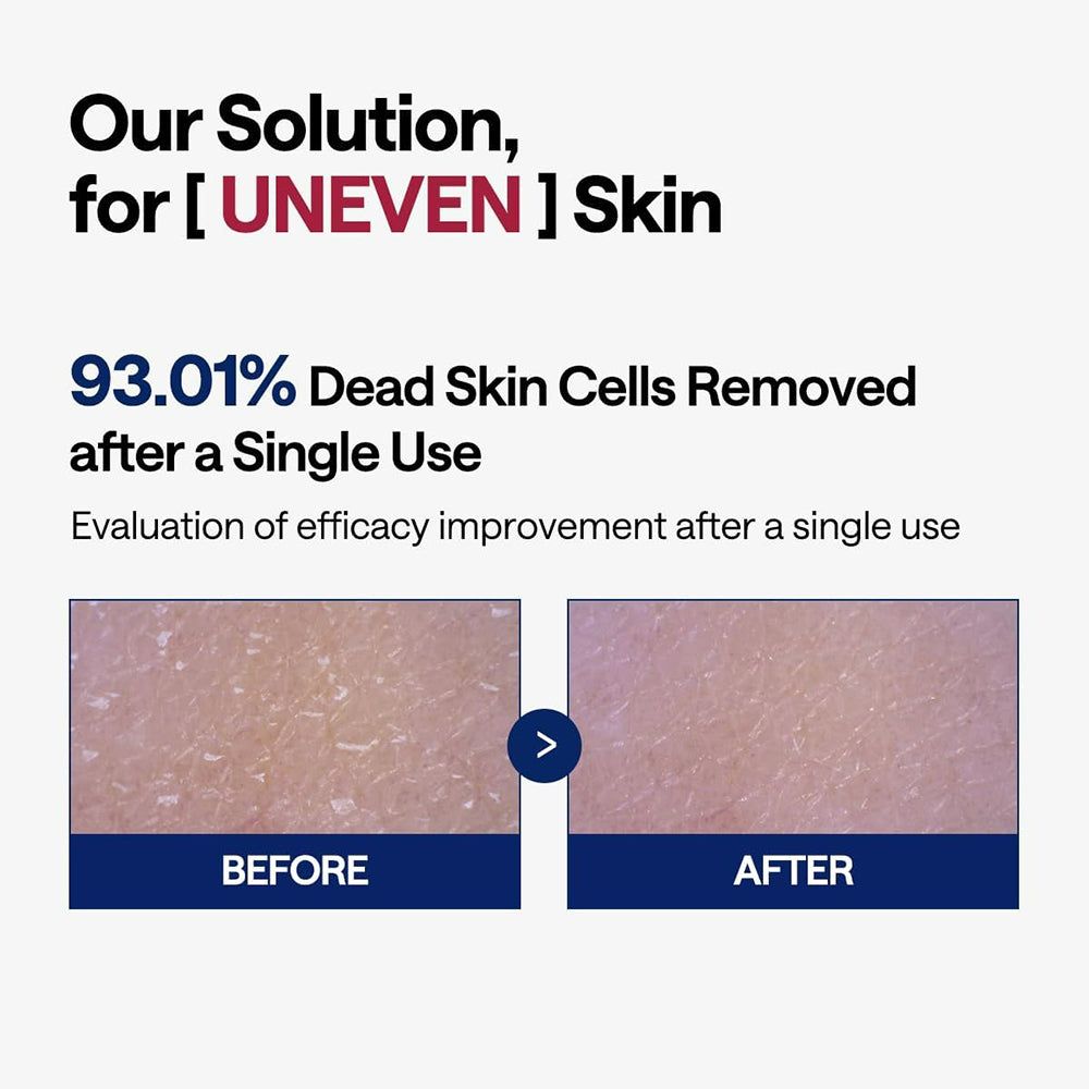 Comparaison avant-après. Texte : "93.01% Dead Skin Cells Removed". Deux images de peau, avant et après utilisation.