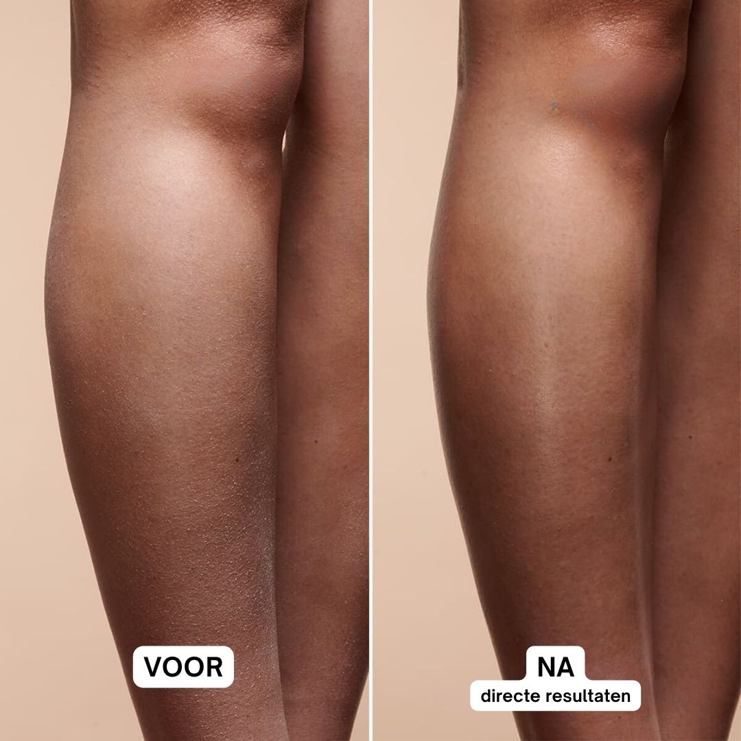 Benen voor en na gebruik. Voor: droge huid. Na: gladde huid. Tekst: Directe resultaten.