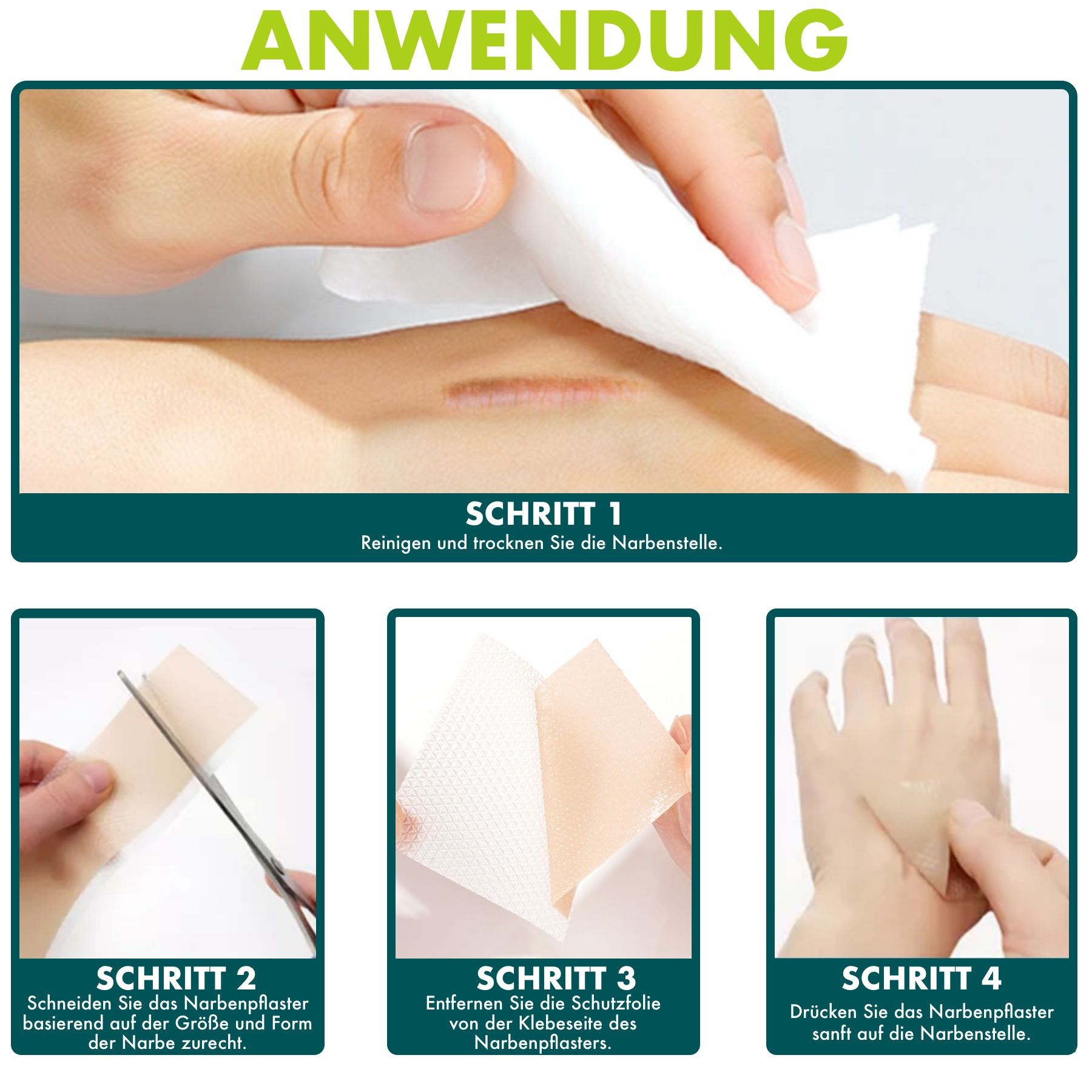 Toepassingsstappen voor siliconenpleisters. Reinigen, drogen, knippen, beschermfolie verwijderen, opplakken.