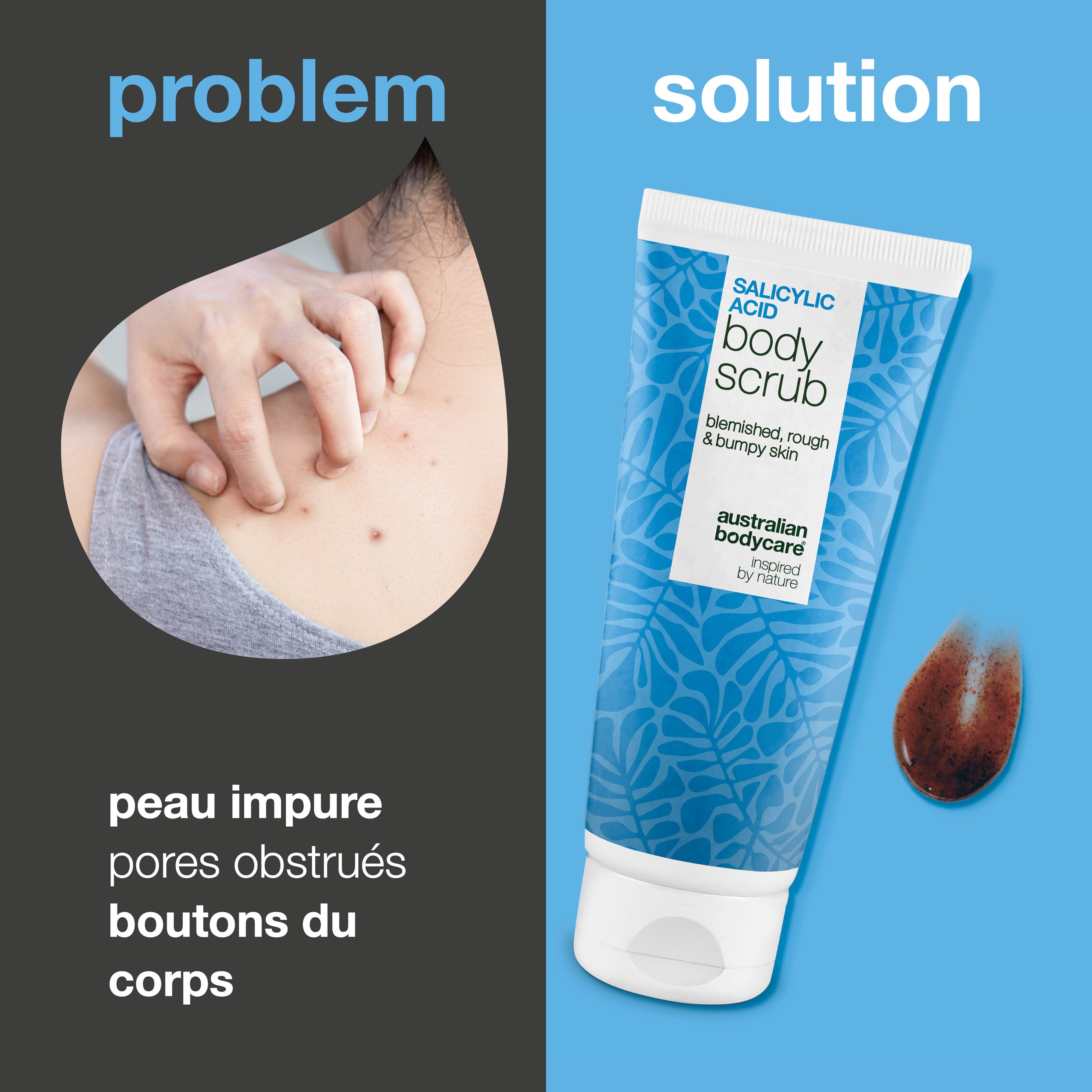 Comparaison: peau impure et gommage corporel. Tube de gommage corporel. Produit brun à côté. Texte: Acide salicylique.