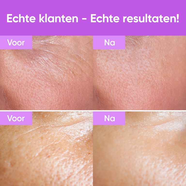 Hand houdt flacon Youth Concentrate Serum vast met tekst over ingrediënten in het Nederlands.