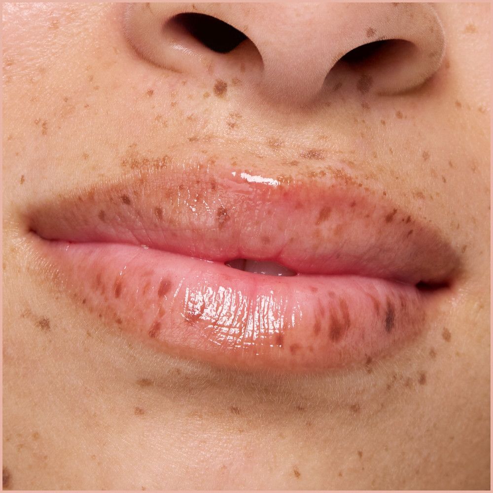 Gros plan sur des lèvres brillantes. Lèvres avec des taches de rousseur.