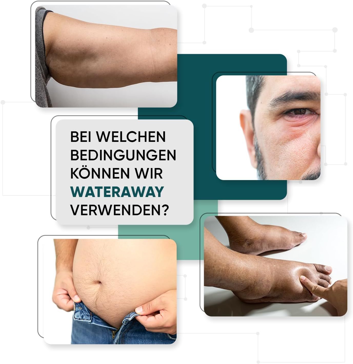 Images de parties du corps. Texte : Dans quelles conditions pouvons-nous utiliser WaterAway ? Œdèmes, surpoids, etc.
