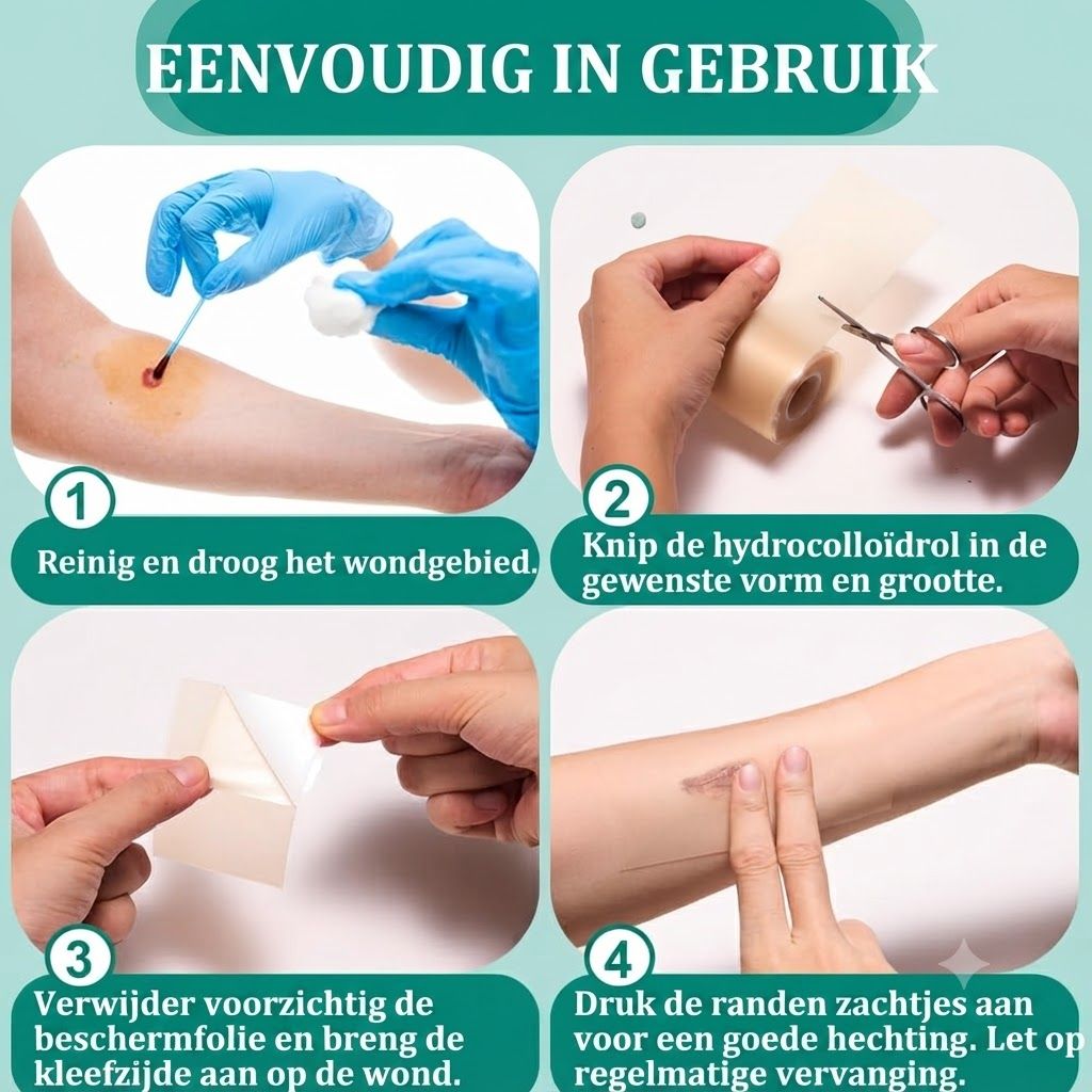 Vier stappen voor wondreiniging en -bedekking met hydrocolloïd.