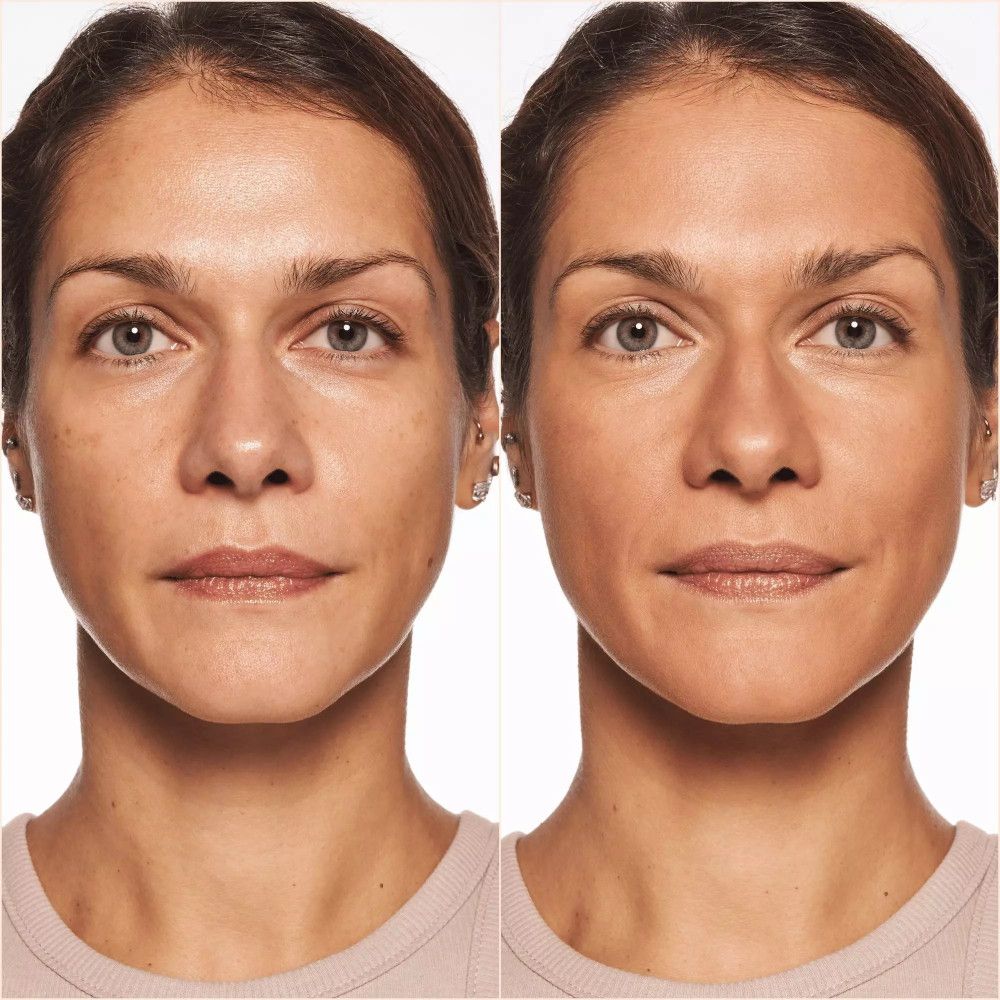 Comparaison avant-après de deux visages. Gauche: imperfections cutanées. Droite: teint uniforme. Les deux femmes ont les cheveux et les yeux foncés.