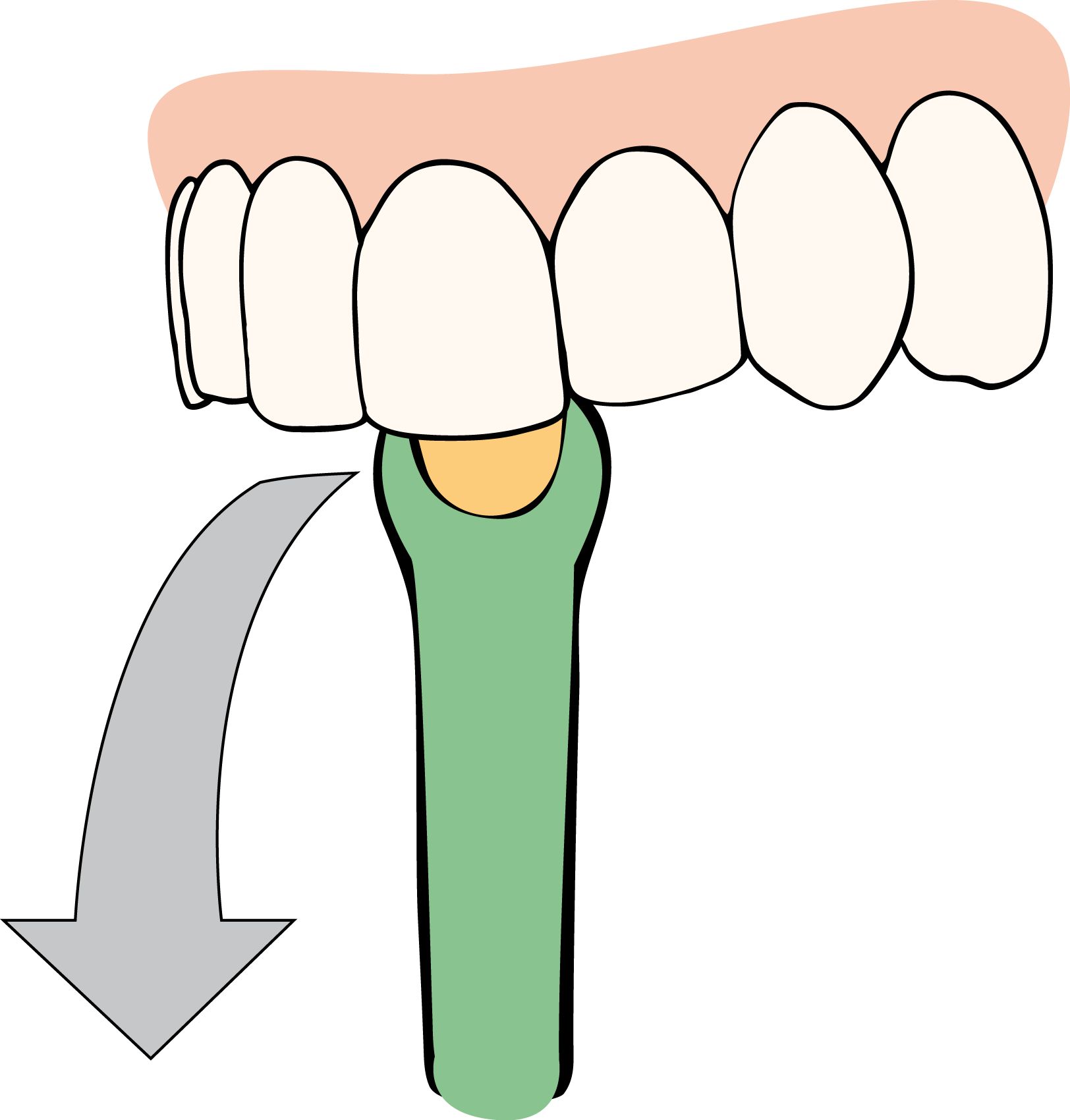 Illustration : brosse à dents sur les dents. La flèche indique la direction du brossage.