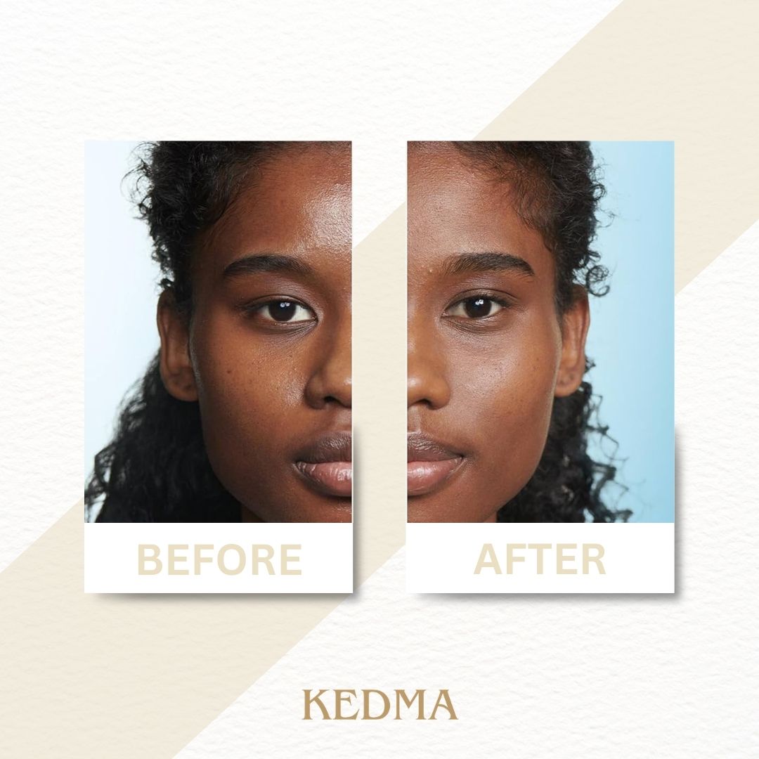Kedma - Masque Exfoliant pour le Visage aux Minéraux de la Mer Morte