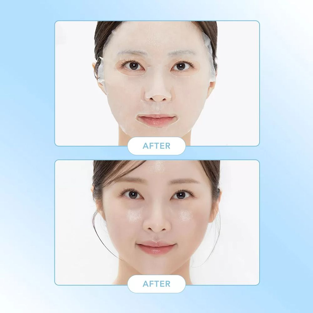 Voor-en-na vergelijking. Twee foto's van een vrouw. Boven: masker op het gezicht. Onder: gezicht zonder masker.