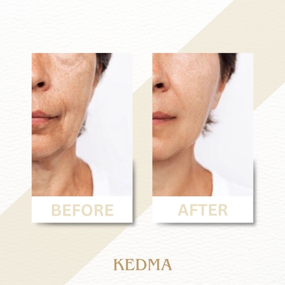 Kedma - Masque Visage à l'Or 24K et aux Minéraux de la Mer Morte